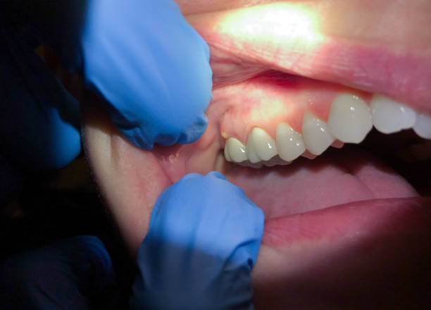 Best Knocked-Out Tooth Emergency  in Mobile, AL