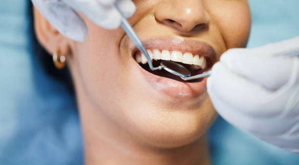 Emergency Dental Filling Replacement in AL